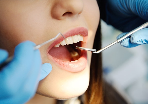 Jak leczyć parodontozę?